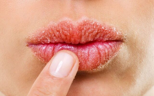 Dưỡng môi - Tại sao lại cần thiết?