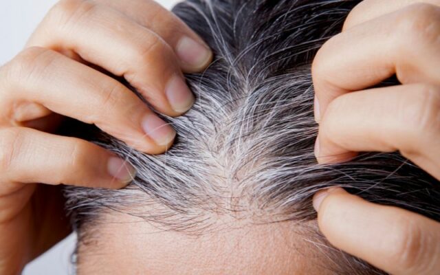 Những nguyên nhân khiến tóc bạc sớm và cách khắc phục